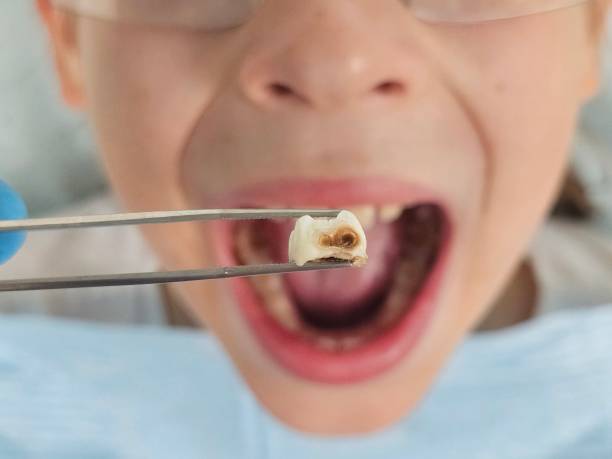 Best Weekend Emergency Dentist in North Tunica, MS
