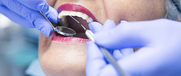 Best Emergency Dental Care for Broken or Chipped Teeth in North Tunica, MS